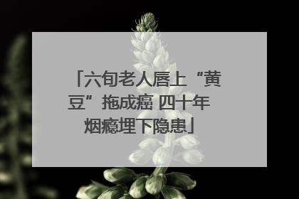 六旬老人唇上“黄豆”拖成癌 四十年烟瘾埋下隐患