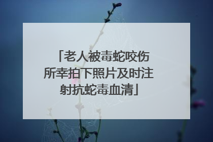 老人被毒蛇咬伤 所幸拍下照片及时注射抗蛇毒血清